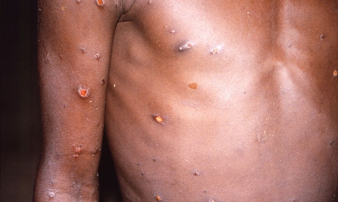 Foto: CDC/Brian W. J. Mahy