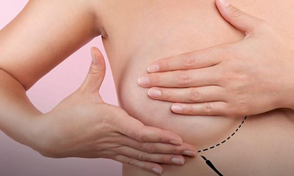 Foto: Divulgação/Sociedade Brasileira de Mastrologia