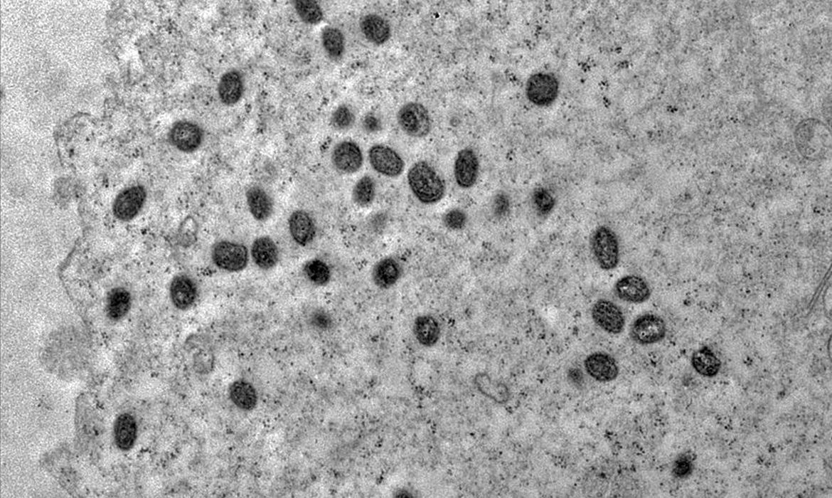 A varíola dos macacos é transmitida pelo vírus monkeypox, que pertence ao gênero orthopoxvirus Foto: Débora F. Barreto-Vieira/IOC/Fiocruz
